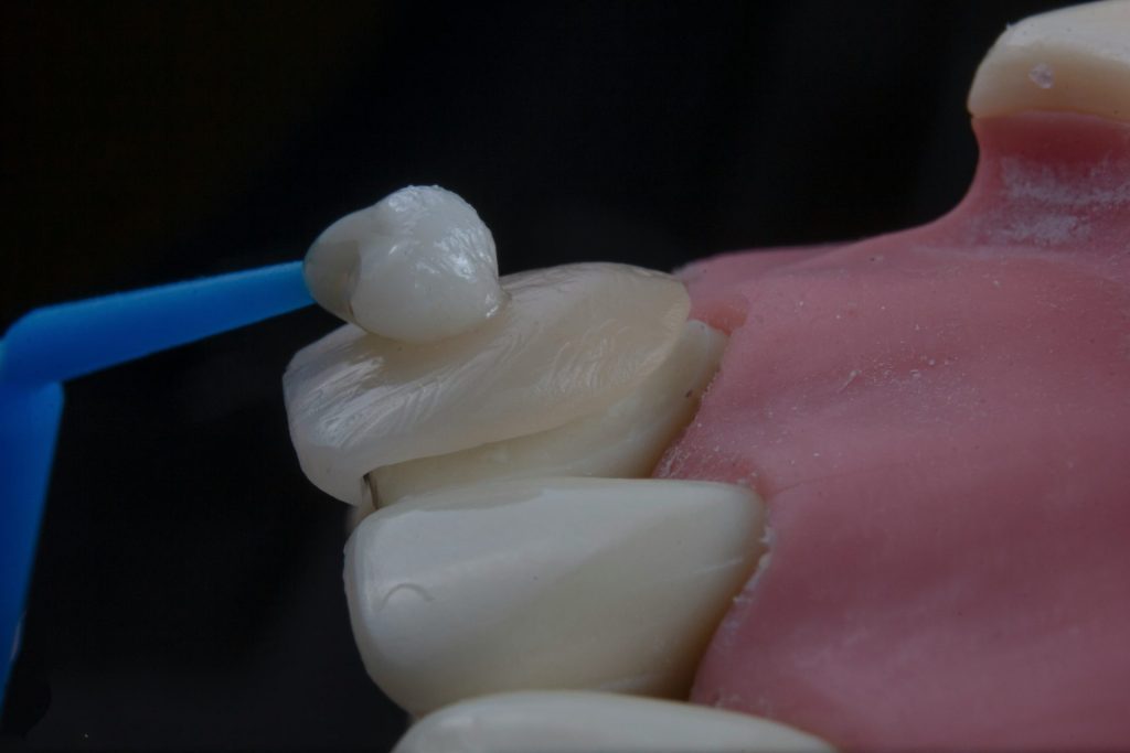 Un primer plano de unas pastillas